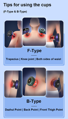 Trend Vakuum-Cupping-Therapie-Set Klasse II Körper-Cupping-Tasse mit OEM ODM Hijama-Tasse