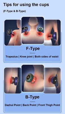OEM Dunkelgrauer elektrischer Cupping Kit für Design Smart Cupping Cups Therapie Massager Sets