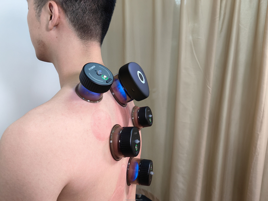 Fitdash Smart Massage Cupping Vakuum Cupping Therapie Maschine mit Tastenkontrolle