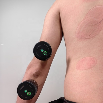 Massageausrüstung Intelligentes Vakuum-Cupping-Massagegerät mit Typ-C-Strommodus