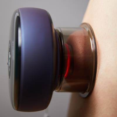 ABS PC professionelles Cupping-Set Elektrische Schraub-Vakuum-Massager für die Cupping-Therapie
