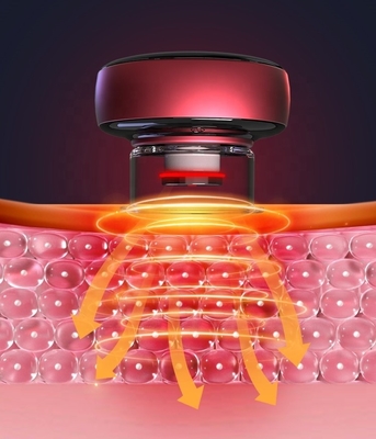 Intelligente elektrische Infrarot-Therapie-Cupping-Maschine mit Saugstärke von 60-0 kPa