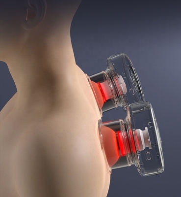 Unterstützung für OEM/ODM Smart Cupping Therapy Massager Cupping Apparat Vakuum Wiederaufladbare Tassen