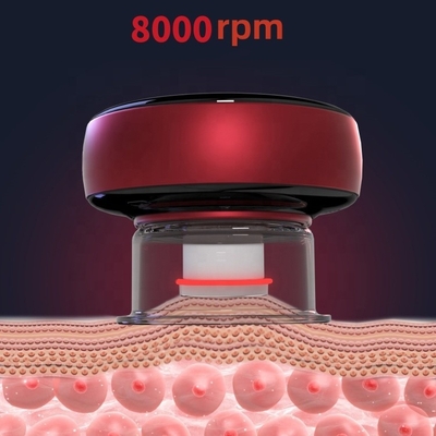Fitdash Cuppers Cupping Physiotherapie Werkzeuge Cupping Therapie Geräte für eine verbesserte Gesundheit