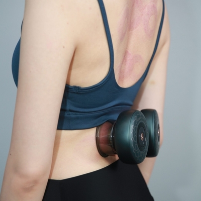 1800mAh Batteriekapazität ABS PC Infrarot-Cupping Ventouse für chinesische Moxa-Therapie