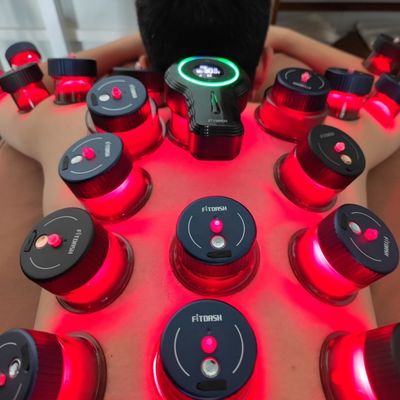 Elektrische Cupping-Therapie-Massager zur Verbesserung der Körperhaltung Saugstärke -10 kPa -60 kPa
