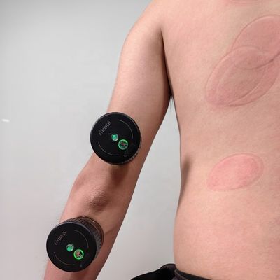 Erleben Sie die Vorteile der elektrischen Vakuum-Cupping-Therapie mit unserem Bechergerät
