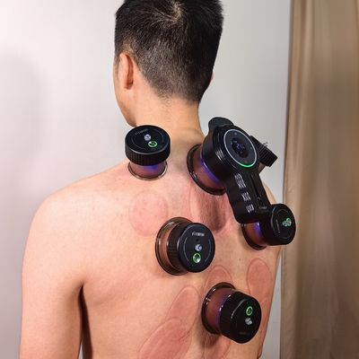 Erleben Sie die Vorteile der elektrischen Vakuum-Cupping-Therapie mit unserem Bechergerät