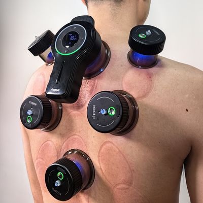 Unterstützung ODM/OEM Fitdash Upgraded Intelligent Electric Vacuum Cupping Set für Gua Sha