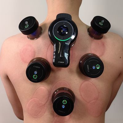 Knopfsteuerungsmethode Vakuum Atmung Cupping Massage zur Behandlung von Anti-Cellulite