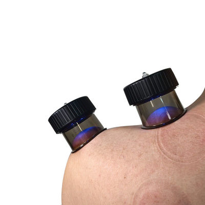 Knopfsteuerungsmethode Vakuum Atmung Cupping Massage zur Behandlung von Anti-Cellulite