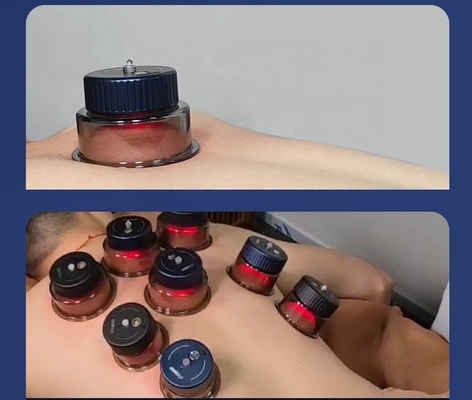 Nennleistung Cupping-Gerät 7w Tasse 1w Fitdash Gua Sha Cupping Stimulationsmassage Ausrüstung