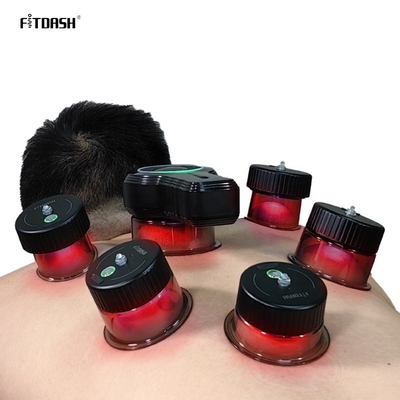 Intelligente Vakuum-Cupping-Therapie zur Verbesserung der Saugfestigkeit des Blutflusses -10 kPa -60 kPa