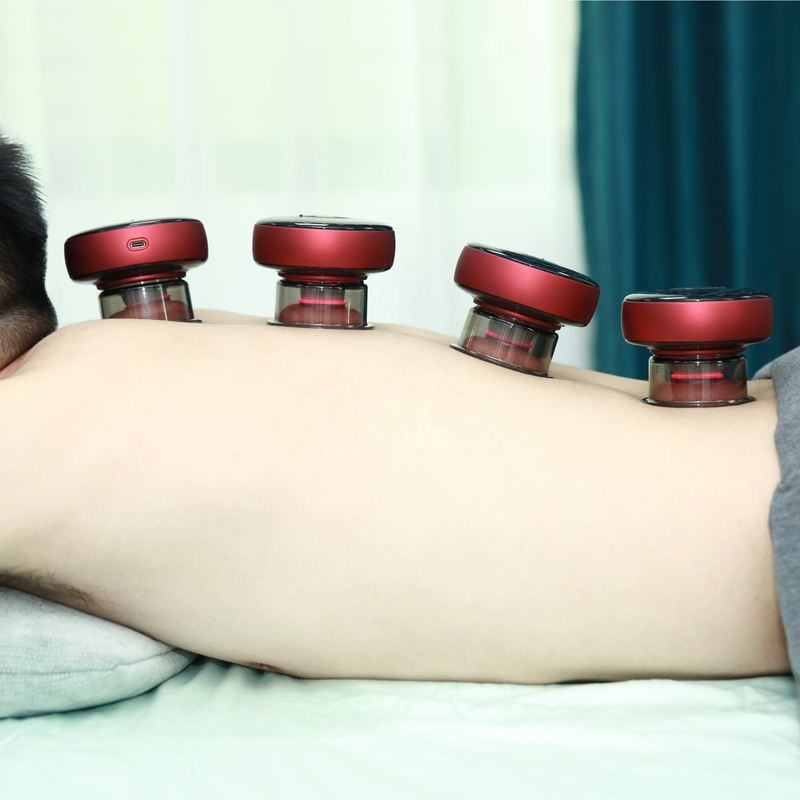 Erleben Sie die Kraft des Fitdash Smart Electric Heat Cupping Vakuumgeräts für Gua Sha